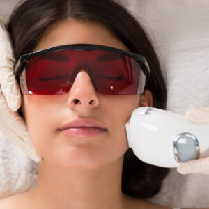 Laser Hair Removal on Face