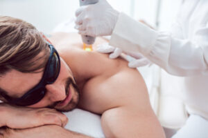 A man undergoing Laser hair removal treatments on his back