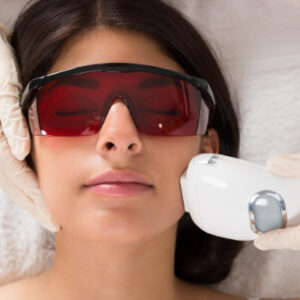 A woman undergoing laser hair removal treatments on her face