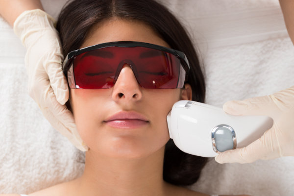 A woman undergoing laser hair removal treatments on her face